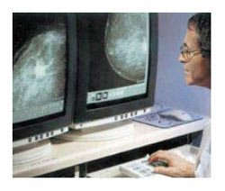 Цифровая маммологическая система Senographe 2000D